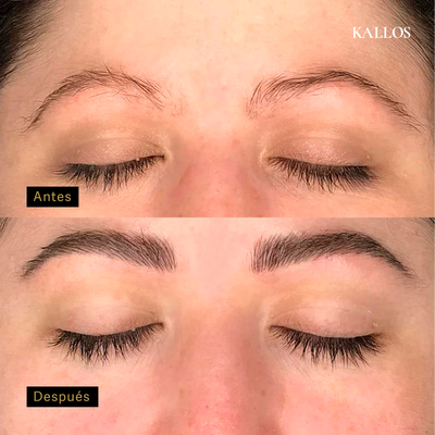 Serum Pestañas